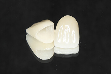 ジルコニアセラミック