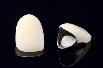 プラスチック前装冠